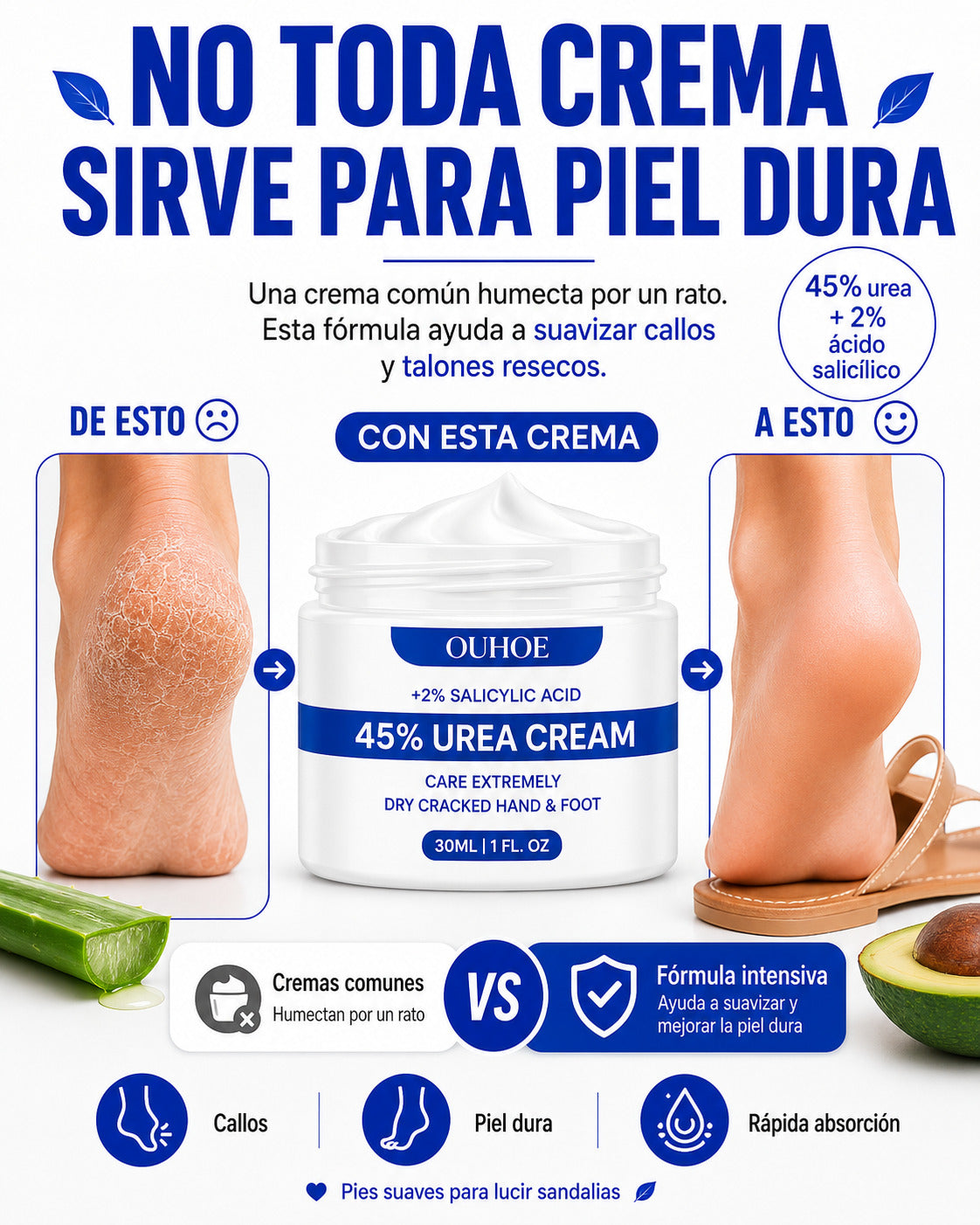 Crema para Callos OUHOE- Para callos que otras cremas no mejoran