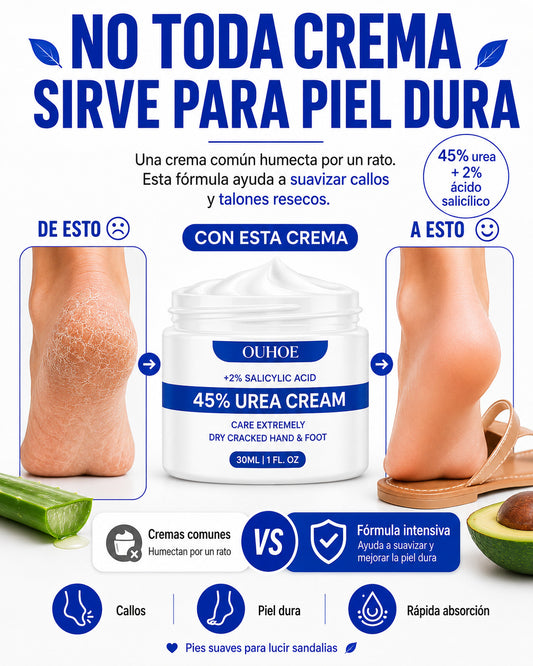 Crema para Callos OUHOE- Para callos que otras cremas no mejoran