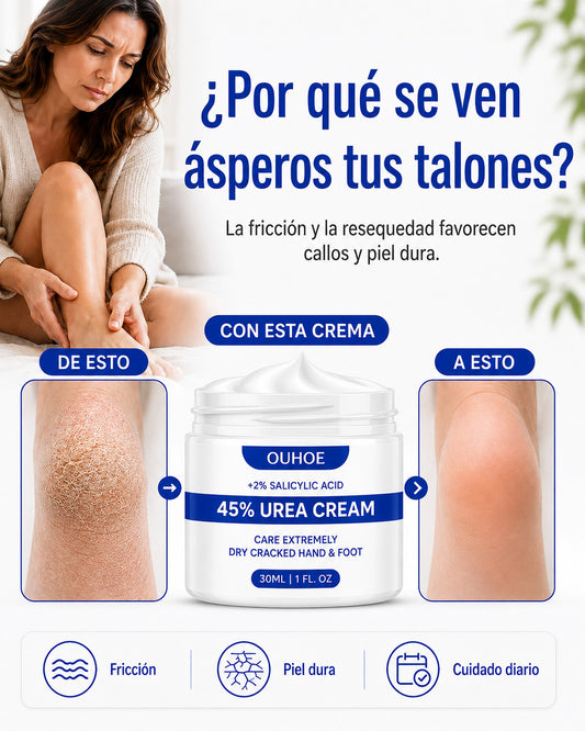 Crema para Callos OUHOE - Suaviza callos y talones resecos
