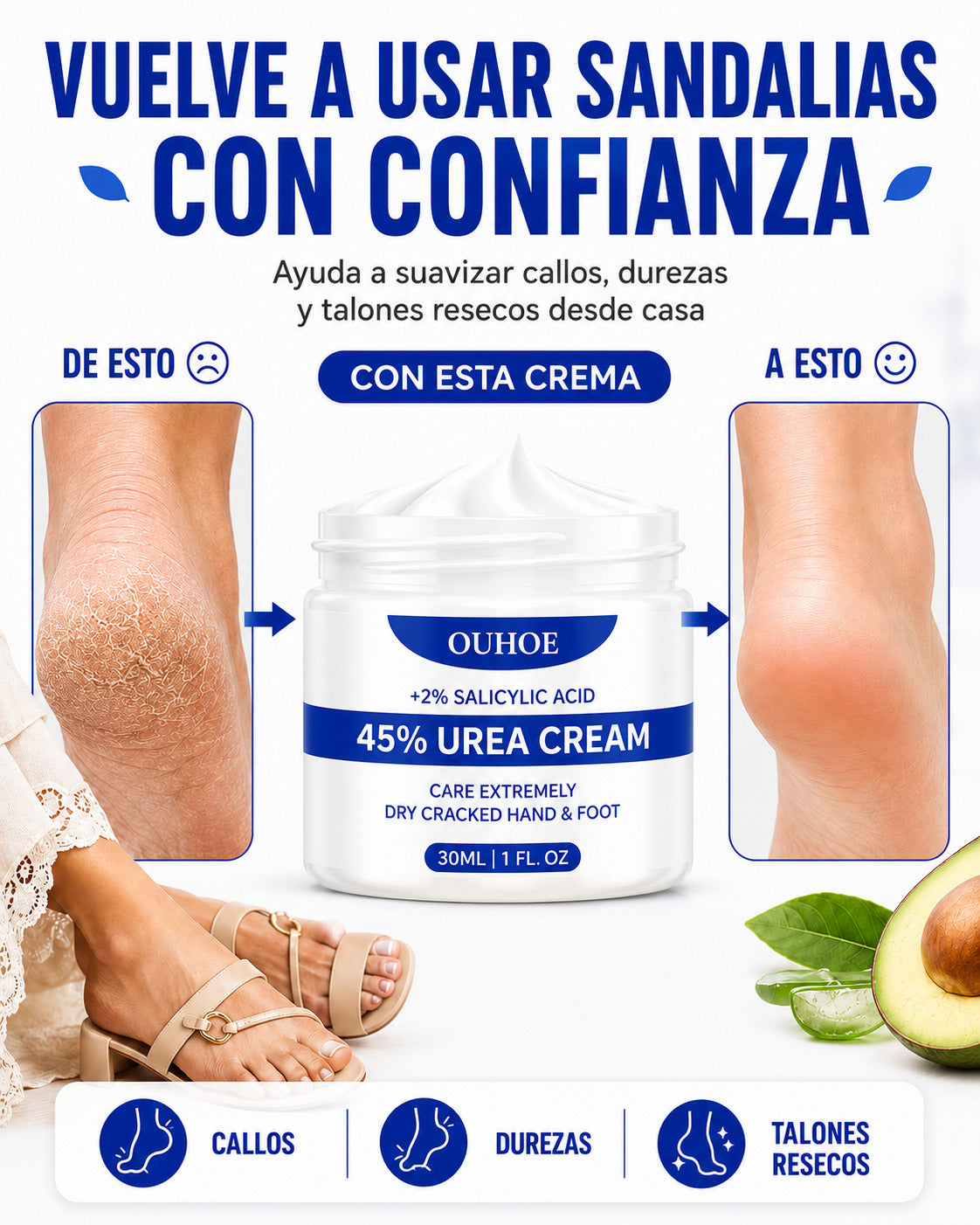 Crema para Callos OUHOE - Vuelve a usar sandalias con confianza