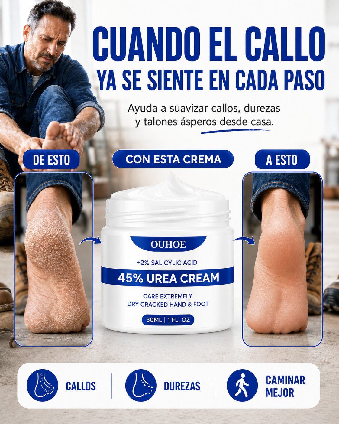 Crema para Callos OUHOE - Camina con mayor comodidad