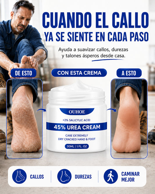 Crema para Callos OUHOE - Camina con mayor comodidad
