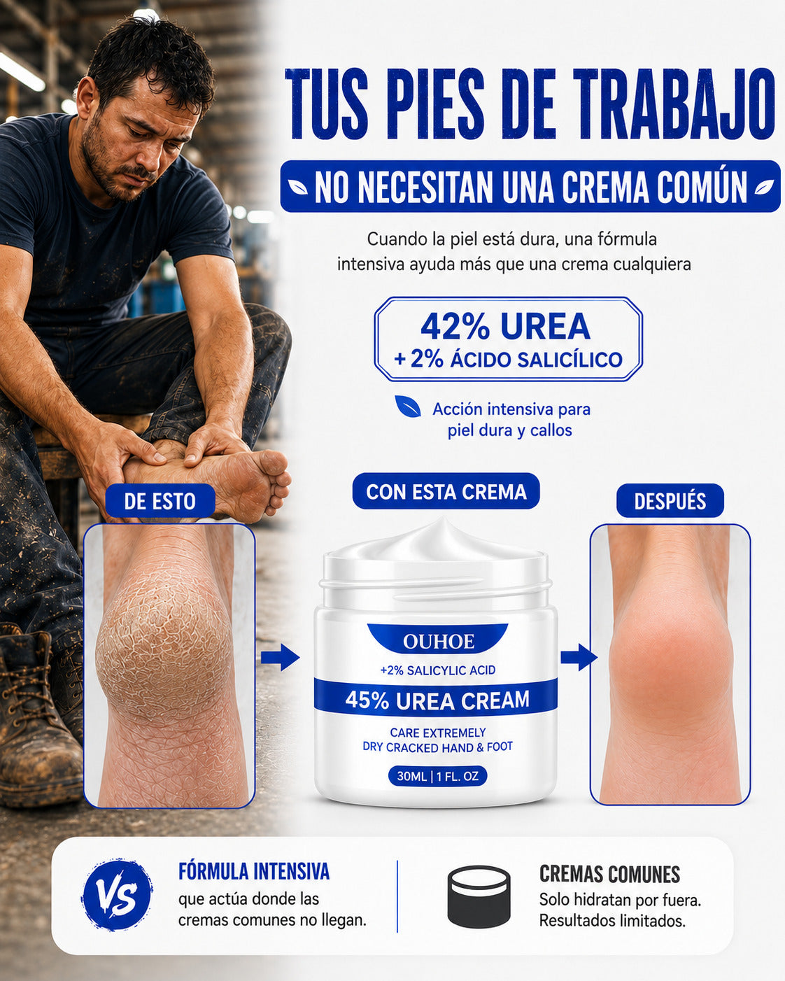 Crema para Callos OUHOE - Cuando limar ya no es suficiente