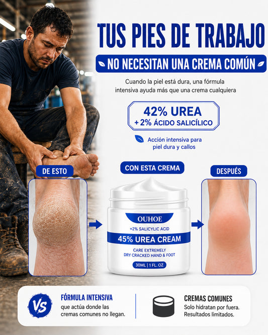 Crema para Callos OUHOE - Cuando limar ya no es suficiente