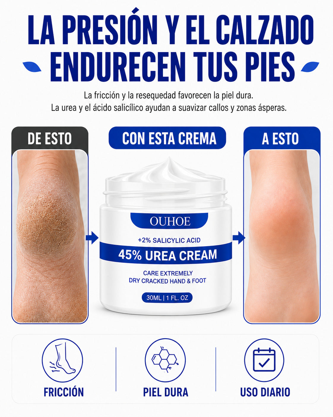 Crema para Callos OUHOE - Ayuda a reducir durezas al caminar