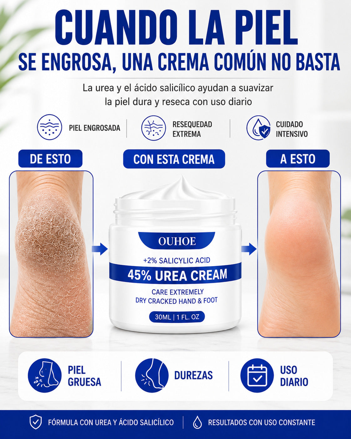 Crema para Callos OUHOE - Mejora el aspecto de pies resecos